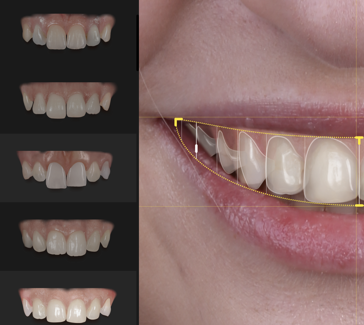 Digital Smile Design